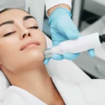 Mesotherapy Treatment in Woodinville, WA by KOCO Medical Aesthetics