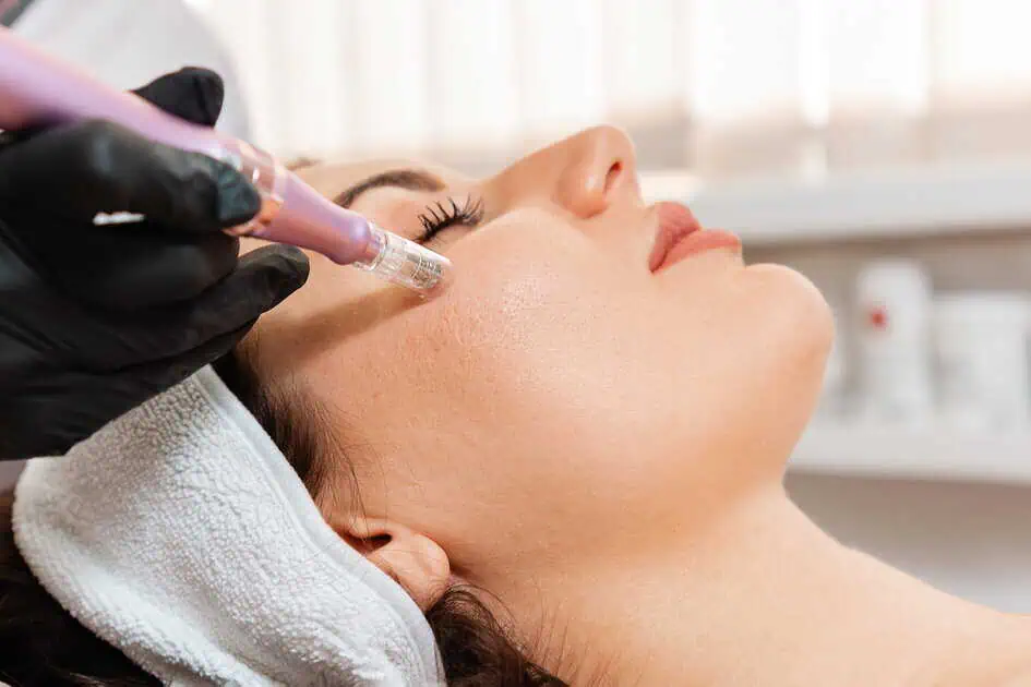 Mesotherapy Treatment in Woodinville WA by KOCO Medical Aesthetics