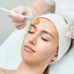 Chemical peels facial treatment on woman at spa in Woodinville, WA