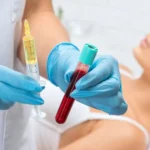 Healthcare professional holding a syringe and a blood tube for a PRP treatment in Woodinville, WA