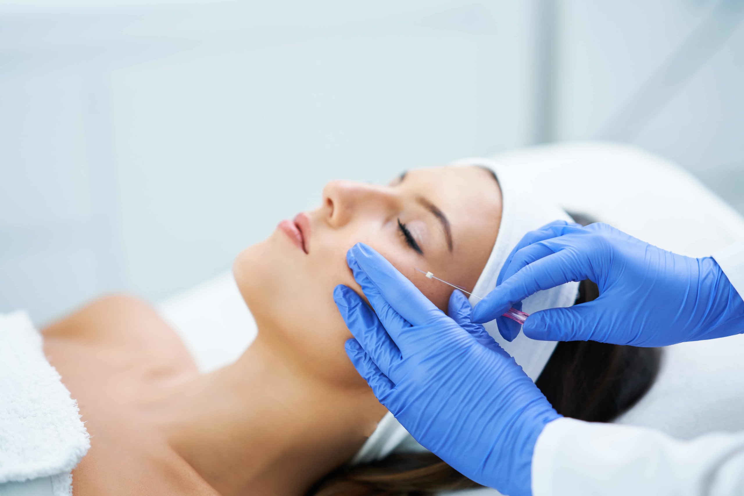 How Can The PDO Thread Lift Improve my Skin