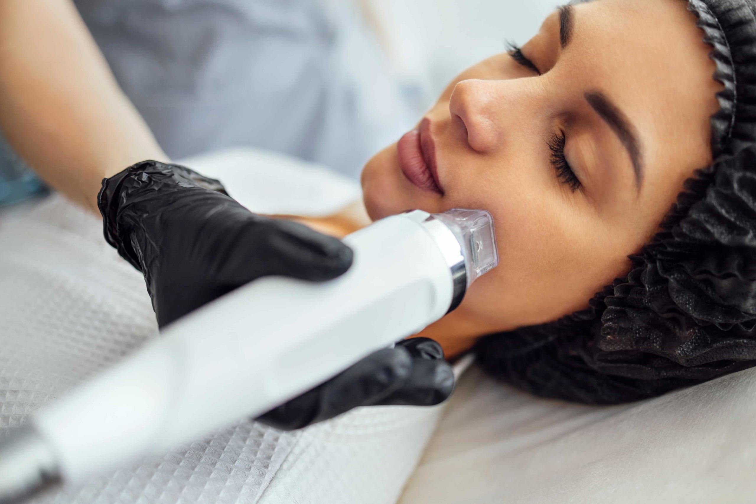 Pixel-8 RF Microneedling Its Benefits and Uses as an Advanced Skin Rejuvenation Treatment