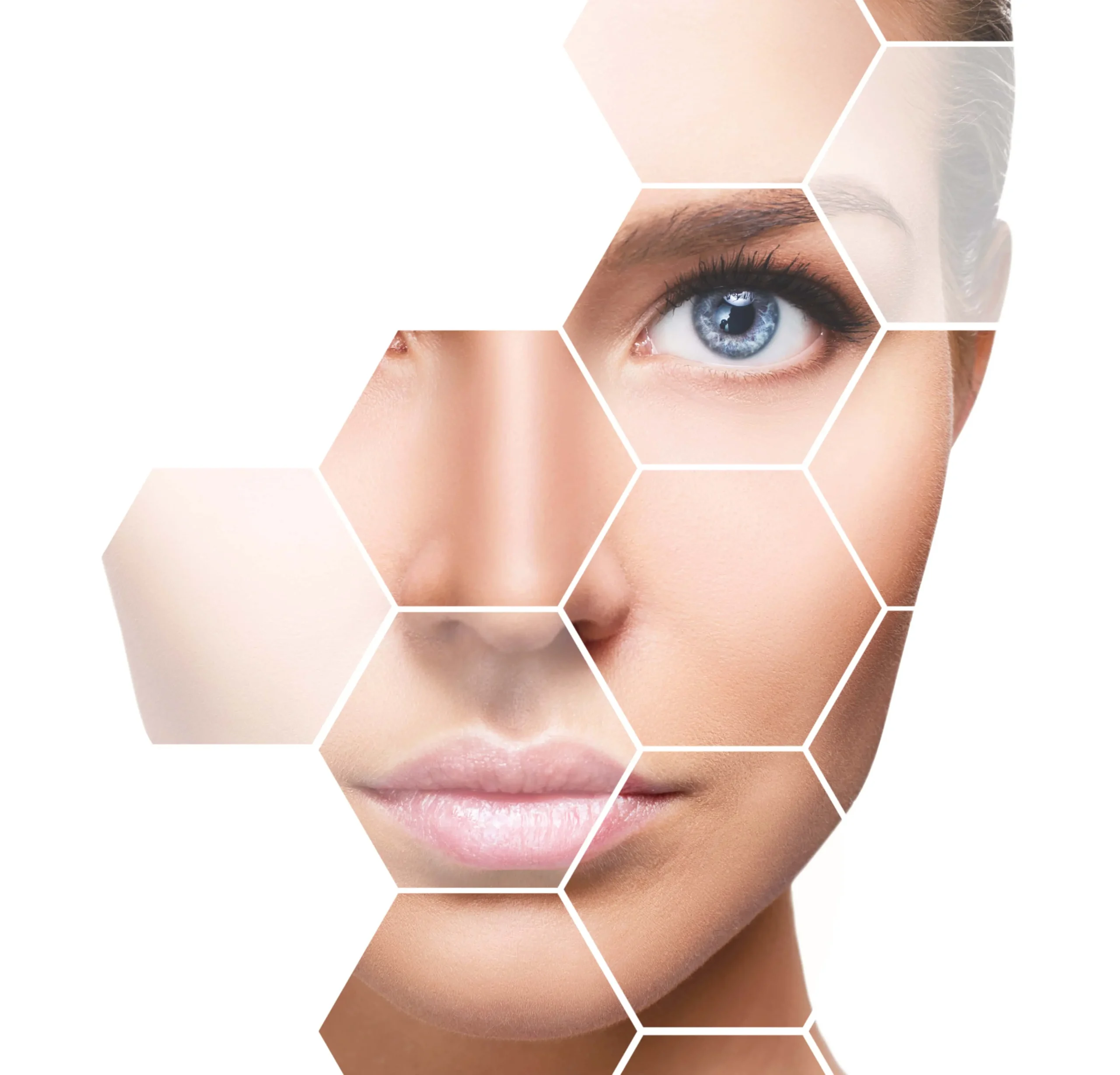 PDO Threads By KOCO Medical Aesthetics in Woodinville WA